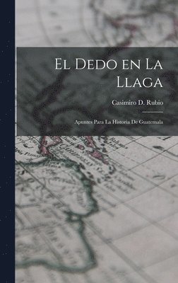 El Dedo en la llaga 1