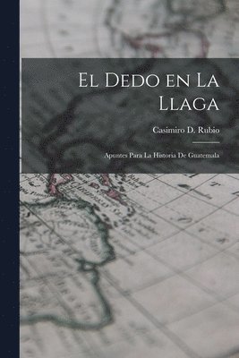 El Dedo en la llaga 1