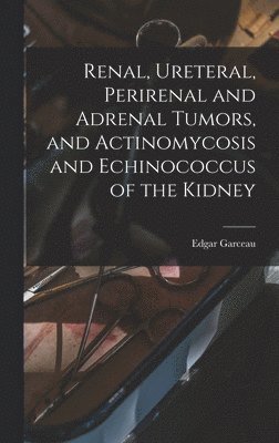 bokomslag Renal, Ureteral, Perirenal and Adrenal Tumors, and Actinomycosis and Echinococcus of the Kidney