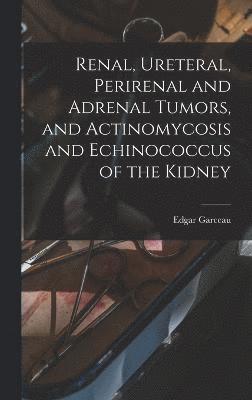 Renal, Ureteral, Perirenal and Adrenal Tumors, and Actinomycosis and Echinococcus of the Kidney 1