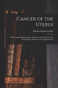 bokomslag Cancer of the Uterus