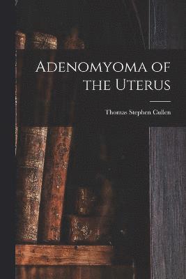 Adenomyoma of the Uterus 1