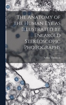 Arthur Thomson - Anatomy of the Human eye as Illustrated by Enlarged Stereoscopic Photographs, Inbunden