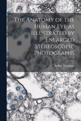 Anatomy of the Human eye as Illustrated by Enlarged Stereoscopic Photographs