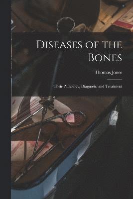 Thomas Jones - Diseases of the Bones, Häftad