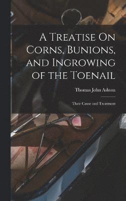Treatise On Corns, Bunions, and Ingrowing of the Toenail