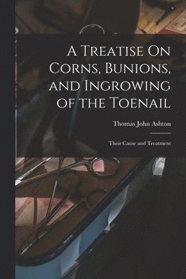 Treatise On Corns, Bunions, and Ingrowing of the Toenail