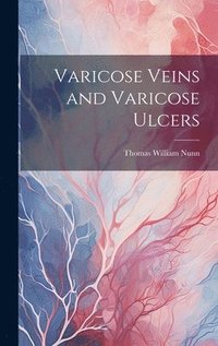 bokomslag Varicose Veins and Varicose Ulcers