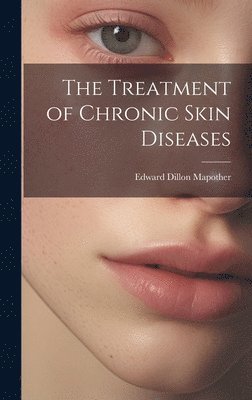 The Treatment of Chronic Skin Diseases 1