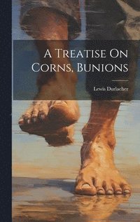 bokomslag A Treatise On Corns, Bunions