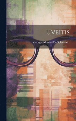 bokomslag Uveitis