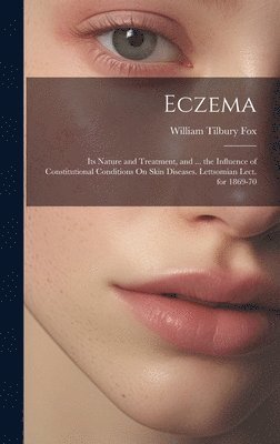 bokomslag Eczema