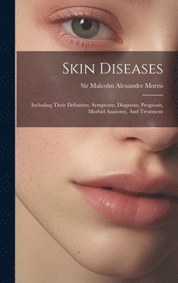 Skin Diseases