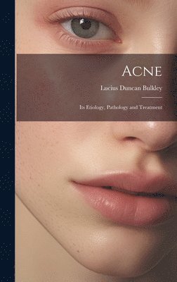 bokomslag Acne