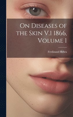 On Diseases of the Skin V.1 1866, Volume 1 1