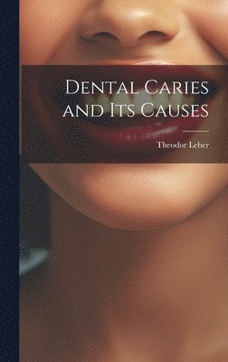 bokomslag Dental Caries and Its Causes