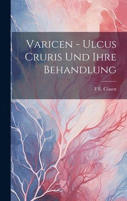 Varicen - Ulcus Cruris Und Ihre Behandlung 1