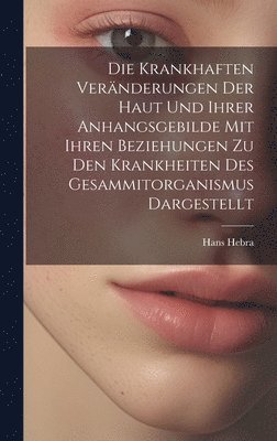 bokomslag Krankhaften Veränderungen Der Haut Und Ihrer Anhangsgebilde Mit Ihren Beziehungen Zu Den Krankheiten Des Gesammitorganismus Dargestellt