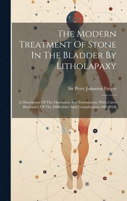 The Modern Treatment Of Stone In The Bladder By Litholapaxy 1