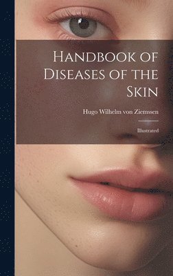 bokomslag Handbook of Diseases of the Skin; Illustrated