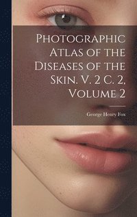 bokomslag Photographic Atlas of the Diseases of the Skin. V. 2 C. 2, Volume 2