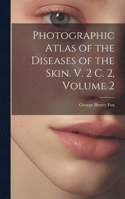 Photographic Atlas of the Diseases of the Skin. V. 2 C. 2, Volume 2 1