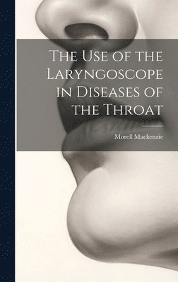 Use of the Laryngoscope in Diseases of the Throat