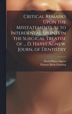 Critical Remarks Upon the Misstatements As to Interdental Splints in the Surgical Treatise of ... D. Hayes Agnew. Journ. of Dentistry