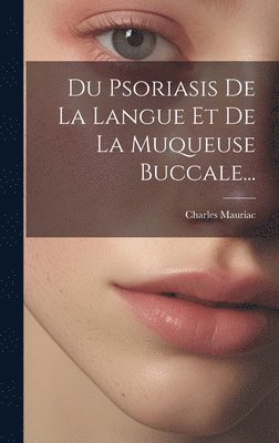 Du Psoriasis De La Langue Et De La Muqueuse Buccale... 1