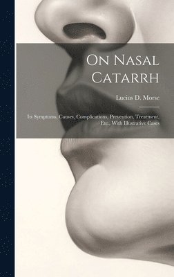 On Nasal Catarrh 1