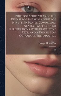 bokomslag Photographic Atlas of the Diseases of the Skin; a Series of Ninety-six Plates, Comprising Nearly two Hundred Illustrations, With Descriptive Text, and a Treatise on Cutaneous Therapeutics