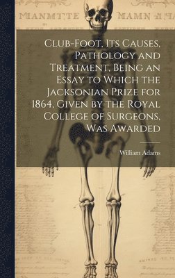 bokomslag Club-foot, its Causes, Pathology and Treatment, Being an Essay to Which the Jacksonian Prize for 1864, Given by the Royal College of Surgeons, was Awarded