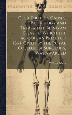 William Adams - Club-foot, its Causes, Pathology and Treatment, Being an Essay to Which the Jacksonian Prize for 1864, Given by the Royal College of Surgeons, was Awarded, Inbunden