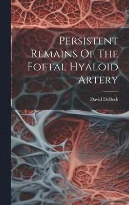 Persistent Remains Of The Foetal Hyaloid Artery 1