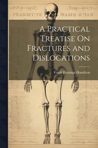 bokomslag A Practical Treatise On Fractures and Dislocations