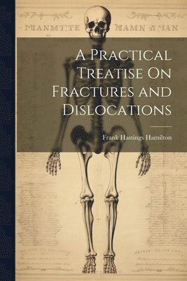 A Practical Treatise On Fractures and Dislocations 1