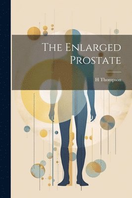 bokomslag Enlarged Prostate