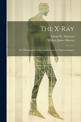 William James Morton, Edwin W Hammer, Edwin W. Hammer - X-Ray; Or, Photography of the Invisible and Its Value in Surgery, Häftad