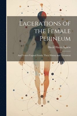 bokomslag Lacerations of the Female Perineum