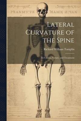 bokomslag Lateral Curvature of the Spine