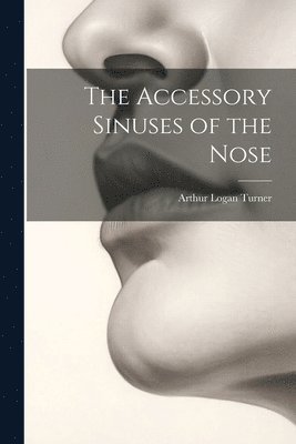 The Accessory Sinuses of the Nose 1