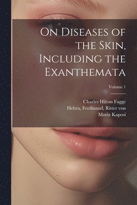 On Diseases of the Skin, Including the Exanthemata; Volume 1 1