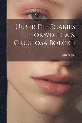 bokomslag Ueber Die Scabies Norwegica S. Crustosa Boeckii