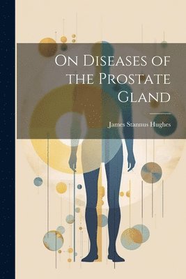 bokomslag On Diseases of the Prostate Gland