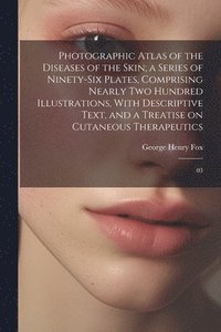 bokomslag Photographic Atlas of the Diseases of the Skin; a Series of Ninety-six Plates, Comprising Nearly two Hundred Illustrations, With Descriptive Text, and a Treatise on Cutaneous Therapeutics