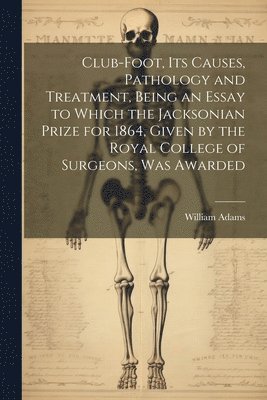 William Adams - Club-foot, its Causes, Pathology and Treatment, Being an Essay to Which the Jacksonian Prize for 1864, Given by the Royal College of Surgeons, was Awarded, Häftad