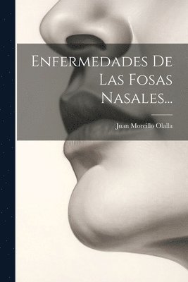 Enfermedades De Las Fosas Nasales... 1
