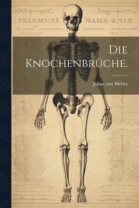 bokomslag Die Knochenbrche.