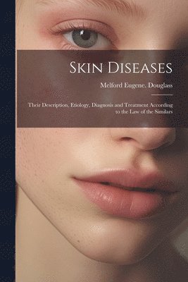 Skin Diseases