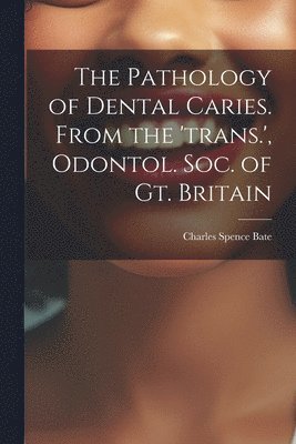 The Pathology of Dental Caries. From the 'trans.', Odontol. Soc. of Gt. Britain 1
